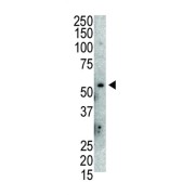 Mdm2 p53 Binding Protein Homolog (MDM2) Antibody