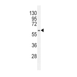Mdm2 p53 Binding Protein Homolog (MDM2) Antibody