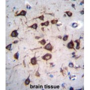 Eukaryotic Translation Elongation Factor 1 Alpha 2 (EEF1A2) Antibody