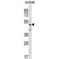 Abl Interactor 2 (ABI2) Antibody