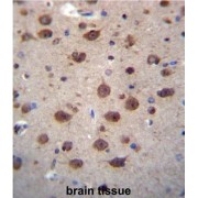 Probable Hydrolase PNKD (PNKD) Antibody