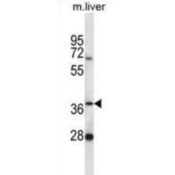 Probable Hydrolase PNKD (PNKD) Antibody
