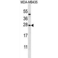 NKG2-A/NKG2-B Type II Integral Membrane Protein (KLRC1) Antibody