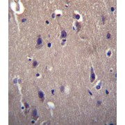 Cocaine And Amphetamine Regulated Transcript Protein (CARTPT) Antibody
