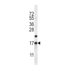Cocaine And Amphetamine Regulated Transcript Protein (CARTPT) Antibody
