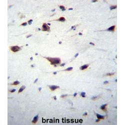 Phosphatidylinositol 3,4,5-Trisphosphate-Dependent Rac Exchanger 1 Protein (PREX1) Antibody