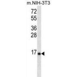 Ribosomal Protein L23 (RPL23) Antibody