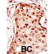 abx026905
