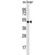 Homeobox Protein Hox-D10 (HOXD10) Antibody