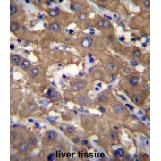 UDP-Glucose 6-Dehydrogenase (UGDH) Antibody