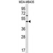 Western blot analysis of extract of MDA-MB435 cell line lysate lysates/protein (35 µg/lane) using KERA antibody.