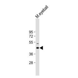 Keratocan (KERA) Antibody