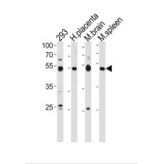 Histone H4 Transcription Factor (HINFP) Antibody