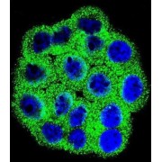 Cyclin Dependent Kinase Inhibitor 2B (CDKN2B) Antibody