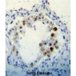 Cyclin Dependent Kinase Inhibitor 2B (CDKN2B) Antibody