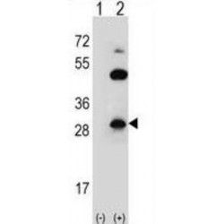 Claudin 2 (CLDN2) Antibody