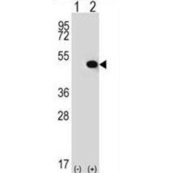 Thyroid Hormone Receptor Interactor 13 (TRIP13) Antibody