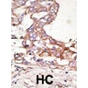 Small Ubiquitin-Related Modifier 4 (SUMO4) Antibody