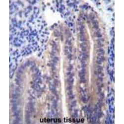 Angiopoietin-Related Protein 7 (ANGPTL7) Antibody