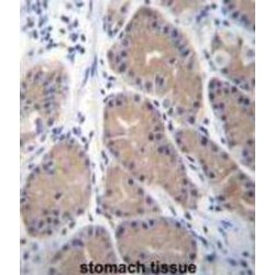 Carbonic Anhydrase 1 (CA1) Antibody