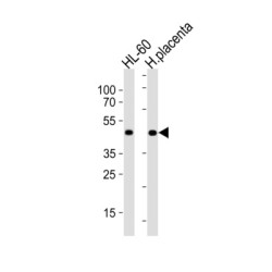 Myoblast Determination Protein 1 (MYOD1) Antibody