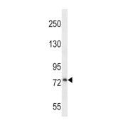 WB analysis of U251 cell line lysates.