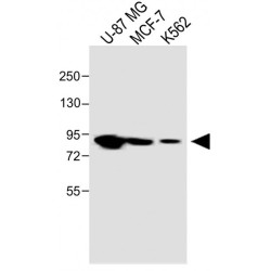 Procollagen Lysine-1,2-Oxoglutarate-5-Dioxygenase 1 (PLOD1) Antibody