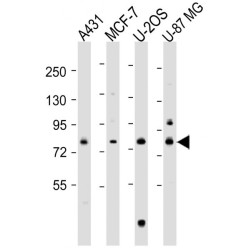 Procollagen Lysine-1,2-Oxoglutarate-5-Dioxygenase 1 (PLOD1) Antibody