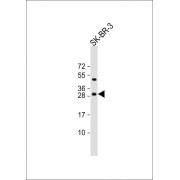 WB analysis of SK-BR-3 whole cell lysate lysates/proteins (20 µg/lane), using Beta-Casein (CSN2) Antibody (1/1000 dilution). Predicted band size: 25 kDa.
