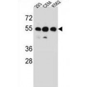Zinc Finger Protein 562 (ZNF562) Antibody