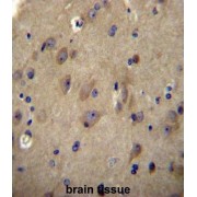 CB1 Cannabinoid Receptor-Interacting Protein 1 (CNRP1) Antibody