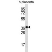 Putative Sodium-Coupled Neutral Amino Acid Transporter 8 (SLC38A8) Antibody