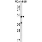 Tripartite Motif Containing 10 (TRIM10) Antibody