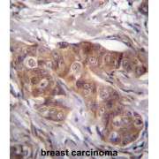 abx026968
