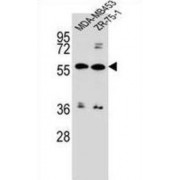 ATP Binding Cassette Subfamily G Member 4 (ABCG4) Antibody