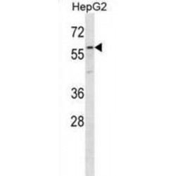 Zona Pellucida Glycoprotein 4 (ZP4) Antibody