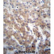 Fibroblast Growth Factor Receptor Like 1 (FGFRL1) Antibody