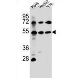 Fibroblast Growth Factor Receptor Like 1 (FGFRL1) Antibody