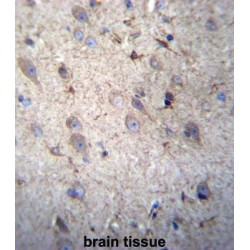 Glutathione S Transferase Mu 5 (GSTM5) Antibody