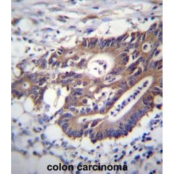 Keratin 12 (KRT12) Antibody