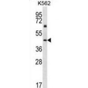 WB analysis of K562 cell lysates (35 µg/lane), using KRT12 antibody.