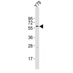 Keratin 12 (KRT12) Antibody