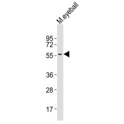 Keratin 12 (KRT12) Antibody