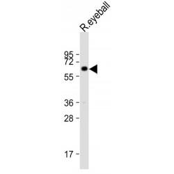 Keratin 12 (KRT12) Antibody