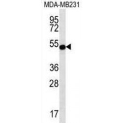 Signal-Transducing Adaptor Protein 2 (STAP2) Antibody