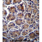 abx026991