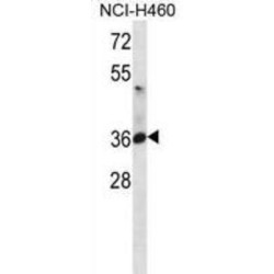 ATPase, Na+/K+ Transporting Beta 3 Polypeptide (ATP1B3) Antibody