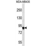 abx026995