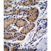 Cathepsin O (CTSO) Antibody
