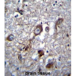 Pleckstrin Homology Domain-Containing Family H Member 1 (PLEKHH1) Antibody